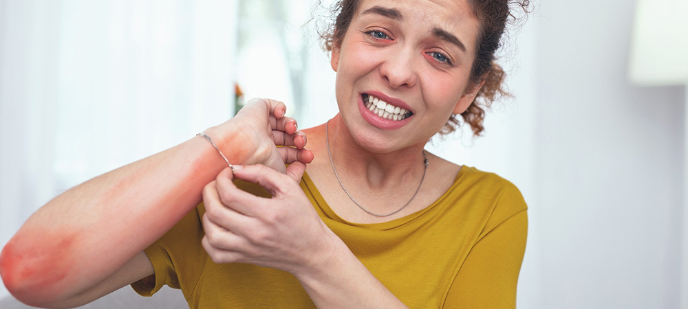 Girl Facing Iching Due to Prurigo Nodularis