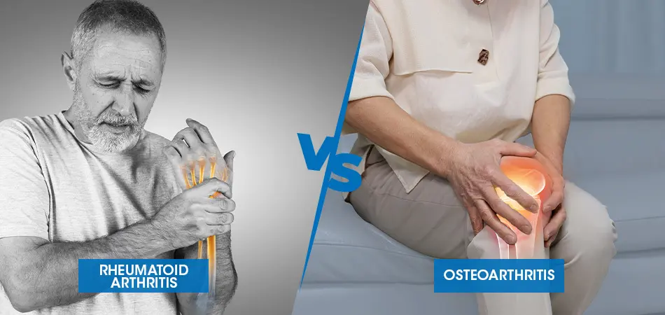 osteoarthritis vs rheumatoid arthritis
