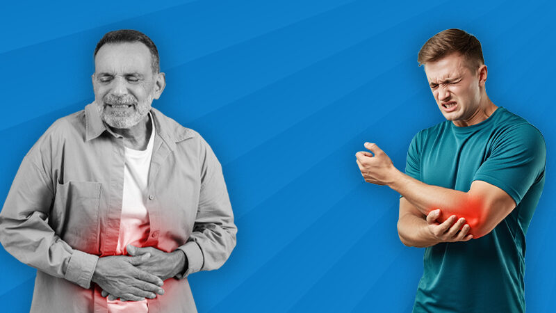 Ulcerative Colitis and Joint Pain