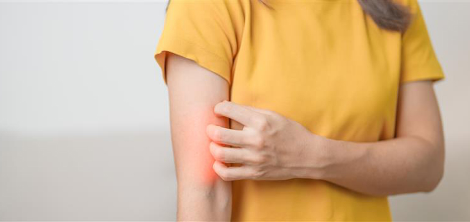Prurigo Nodularis Treatment