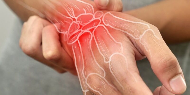 lupus vs rheumatoid arthritis