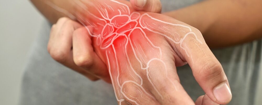 lupus vs rheumatoid arthritis