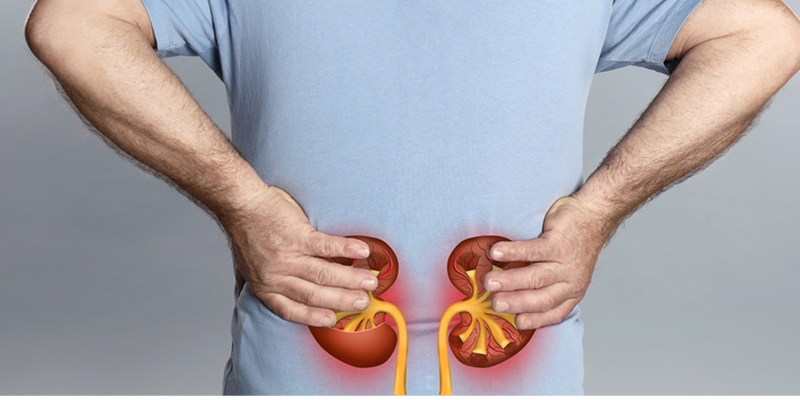 lupus nephritis