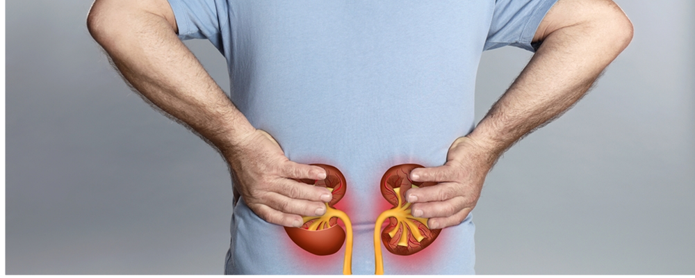 lupus nephritis