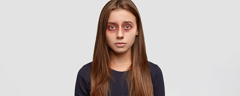 bulging eyes thyroid