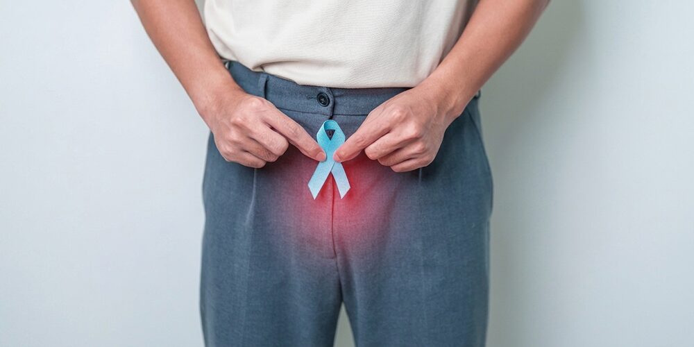prostate-cancer
