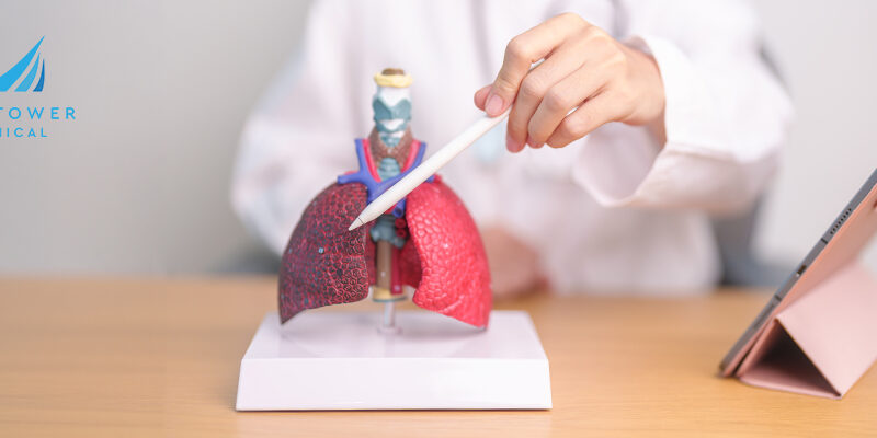 how-to-prevent-lung-cancer