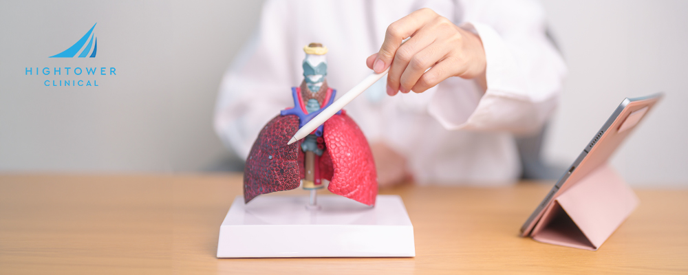 how-to-prevent-lung-cancer