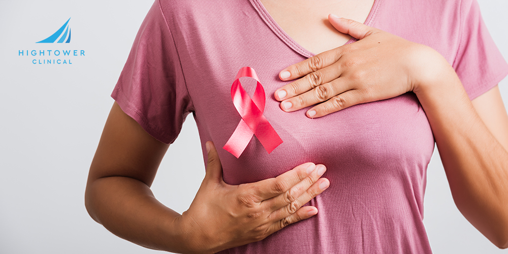 Inflammatory Breast Cancer