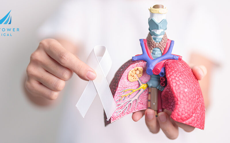 lung-cancer