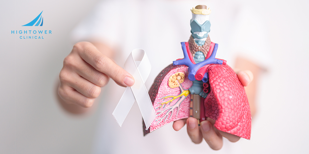 lung-cancer
