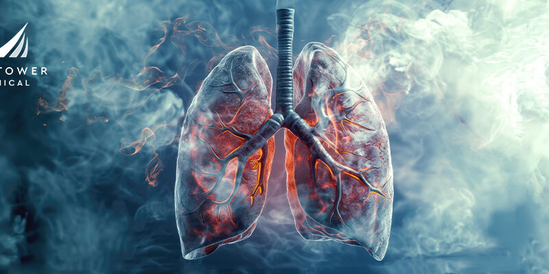 Does Vaping Cause Lung Cancer