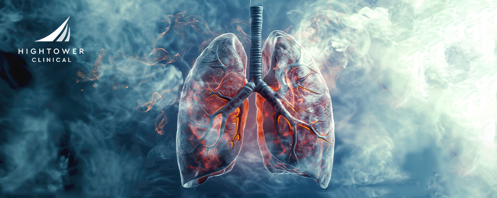 Does Vaping Cause Lung Cancer